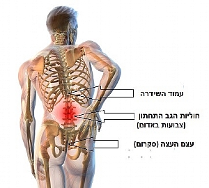 איור נקודות עיקריות שעלולות לגרום לכאבי גב