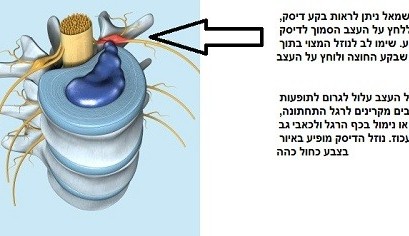 בלט דיסק